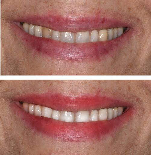 Studio Dentistico Dott. Francesco Rossani logo