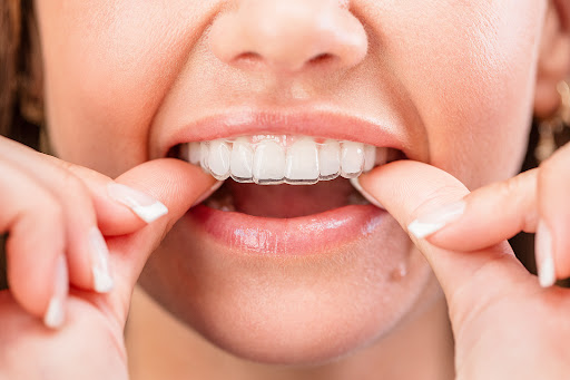 Studio Dentistico Impress logo